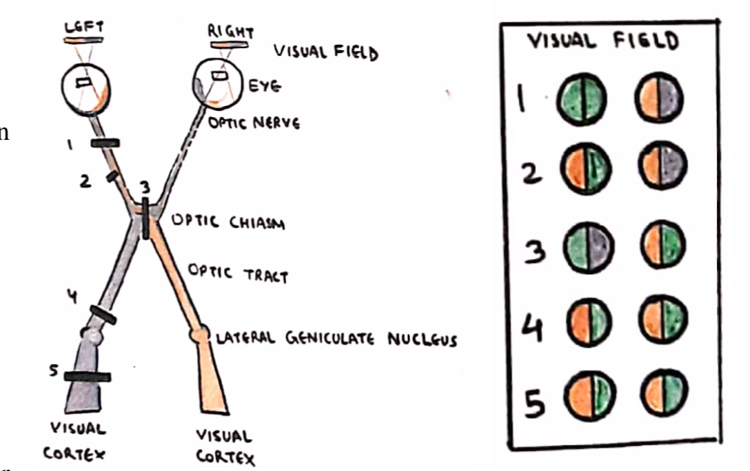 Visual field